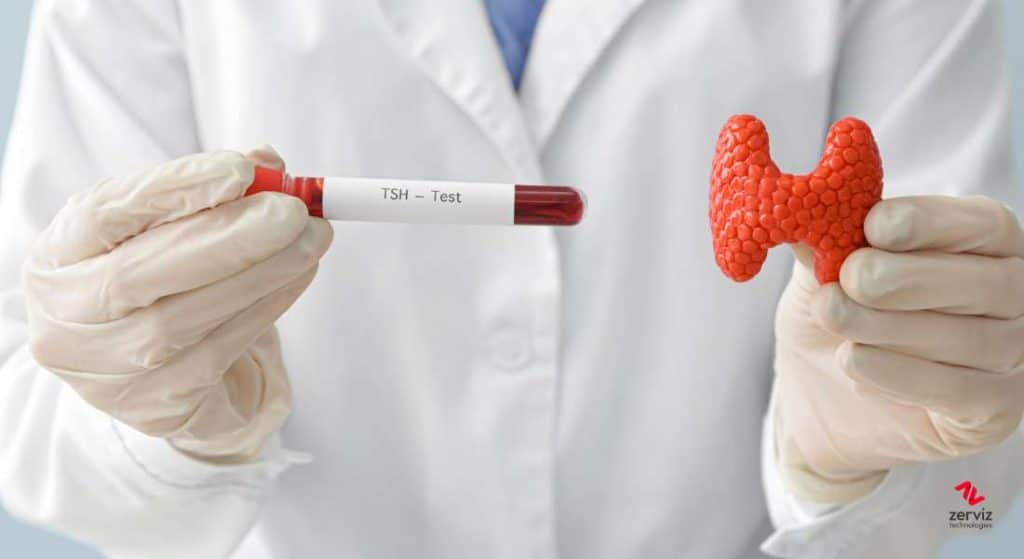 examen hormona tiroestimulante