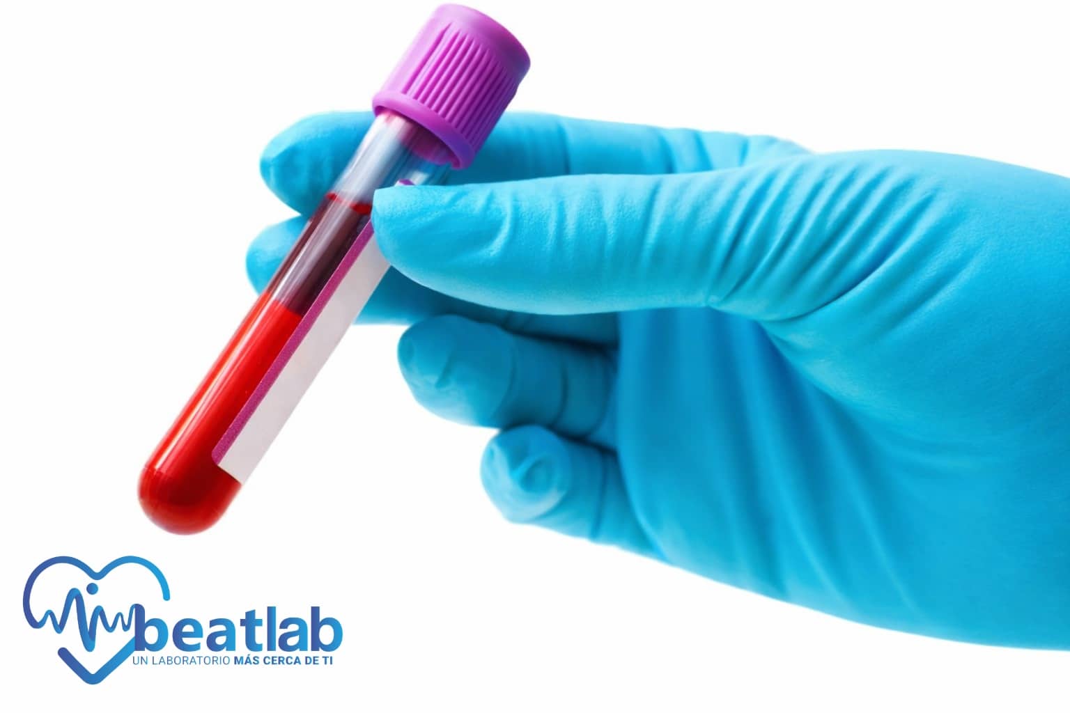 Examen de sangre con tubo para medir VHS alto en laboratorio clínico Beatlab en Rancagua