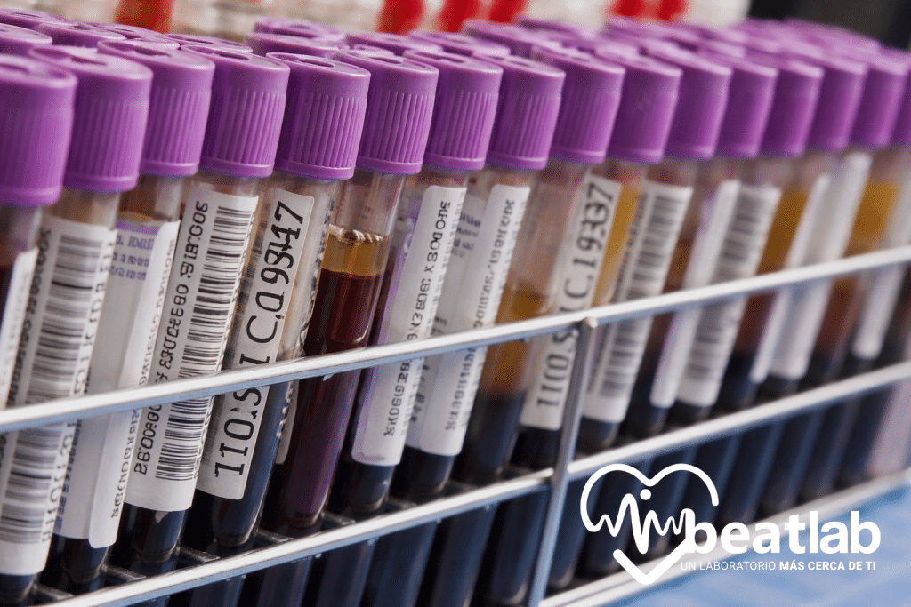 Examen de sangre con tubos para hemograma y VHS en laboratorio clínico en Rancagua