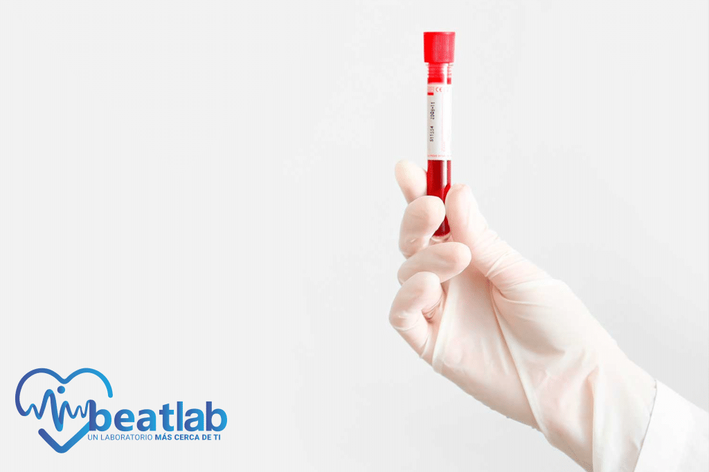 tubo de sangre en laboratorio examen de sangre preparación previa