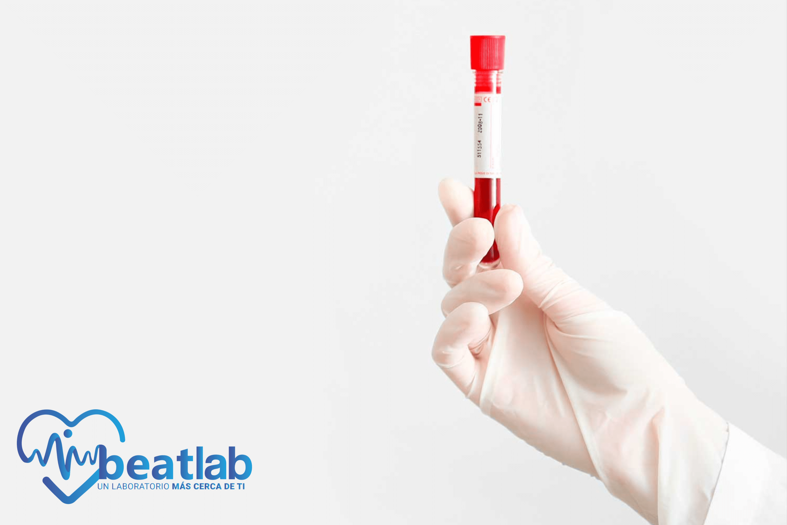 tubo de sangre en laboratorio examen de sangre preparación previa