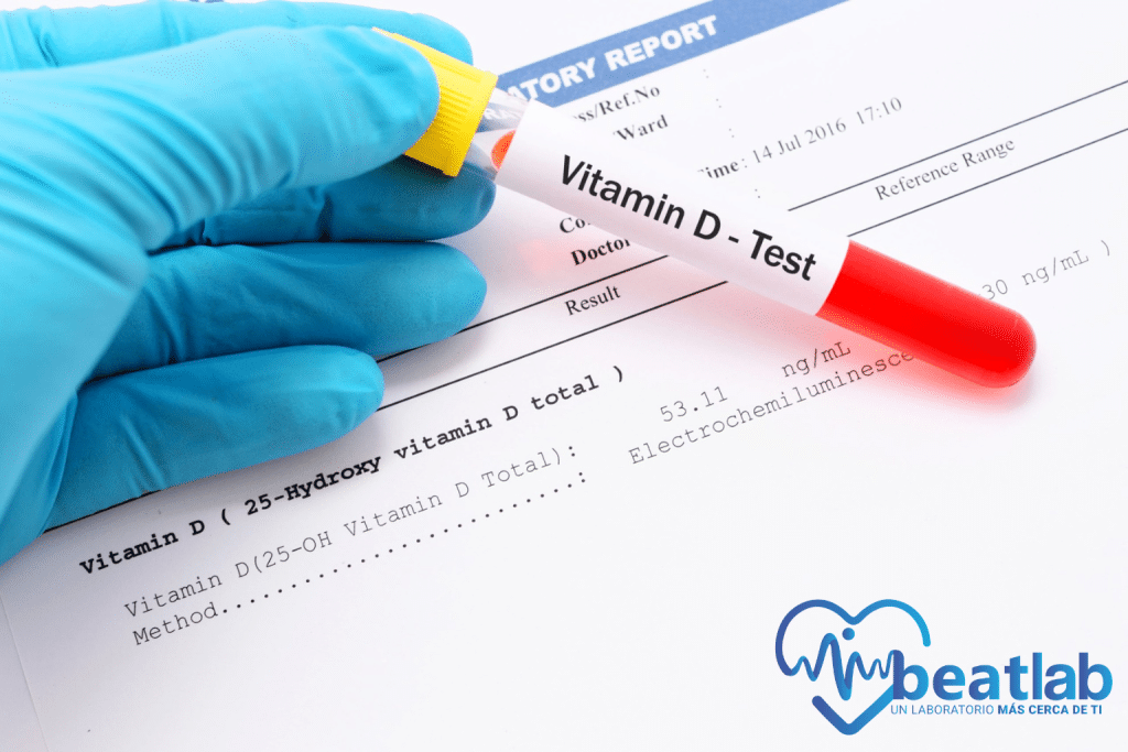 Muestra de sangre para examen de vitamina D sobre informe de laboratorio clínico en Beatlab Rancagua.